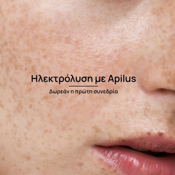 Ηλεκτρόλυση με Apilus